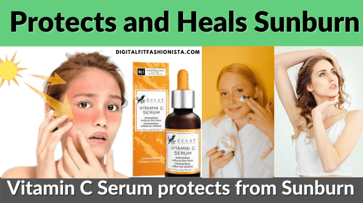  Protects and Heals Sunburn