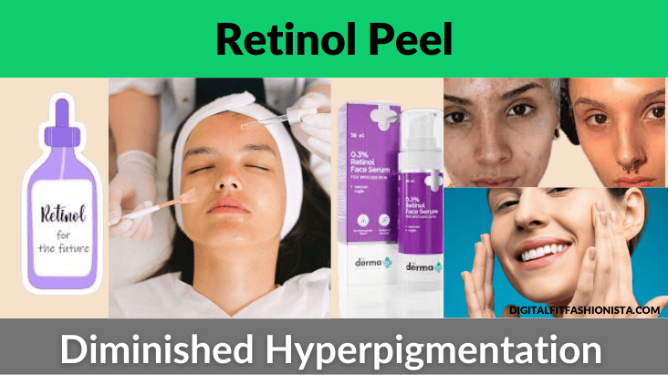 Retinol Peel